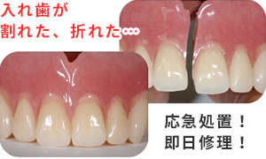 入れ歯の即日修理対応