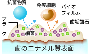 >虫歯菌とバイオフィルム