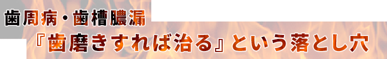 歯周病・歯槽膿漏「歯磨きすれば治る」という落とし穴