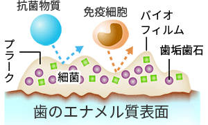 歯の表面のバイオフィルム
