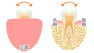 歯の動揺度検査