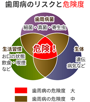 歯周病のリスク（発症要因）と危険度