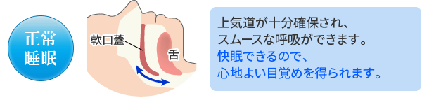 いびきのない正常な睡眠