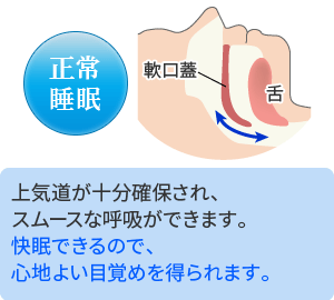 いびきのない正常な睡眠